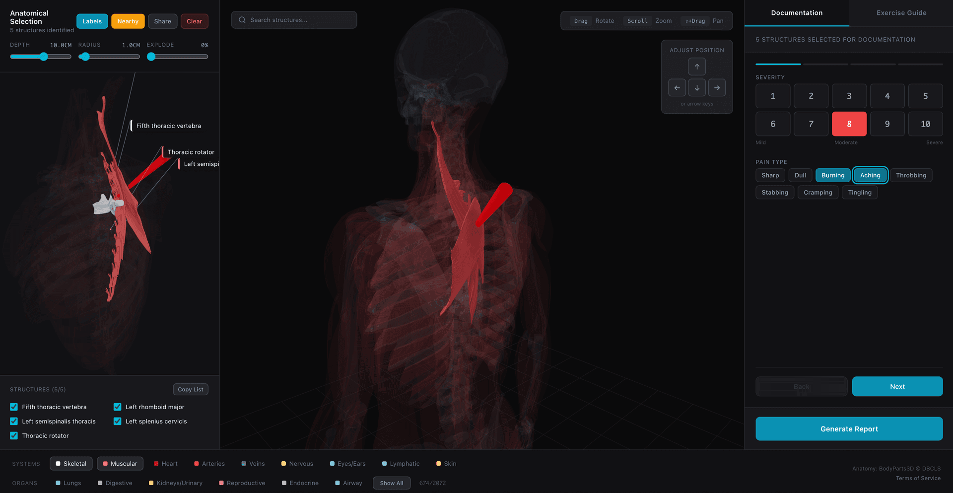 Pinpoint Clinical Mode — 3D body visualization for patient consultations